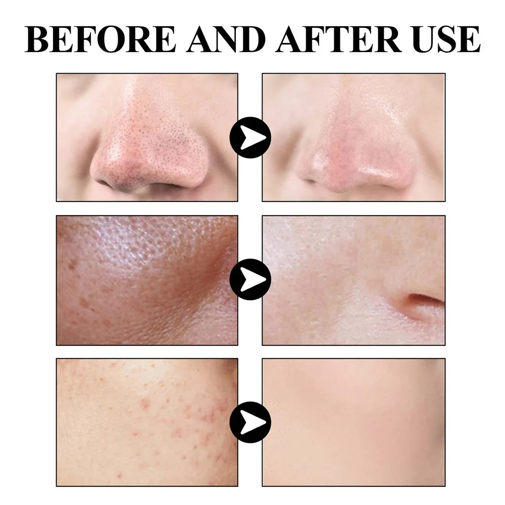 Blackhead Removing Oil Control Refreshing Mud Face Mask