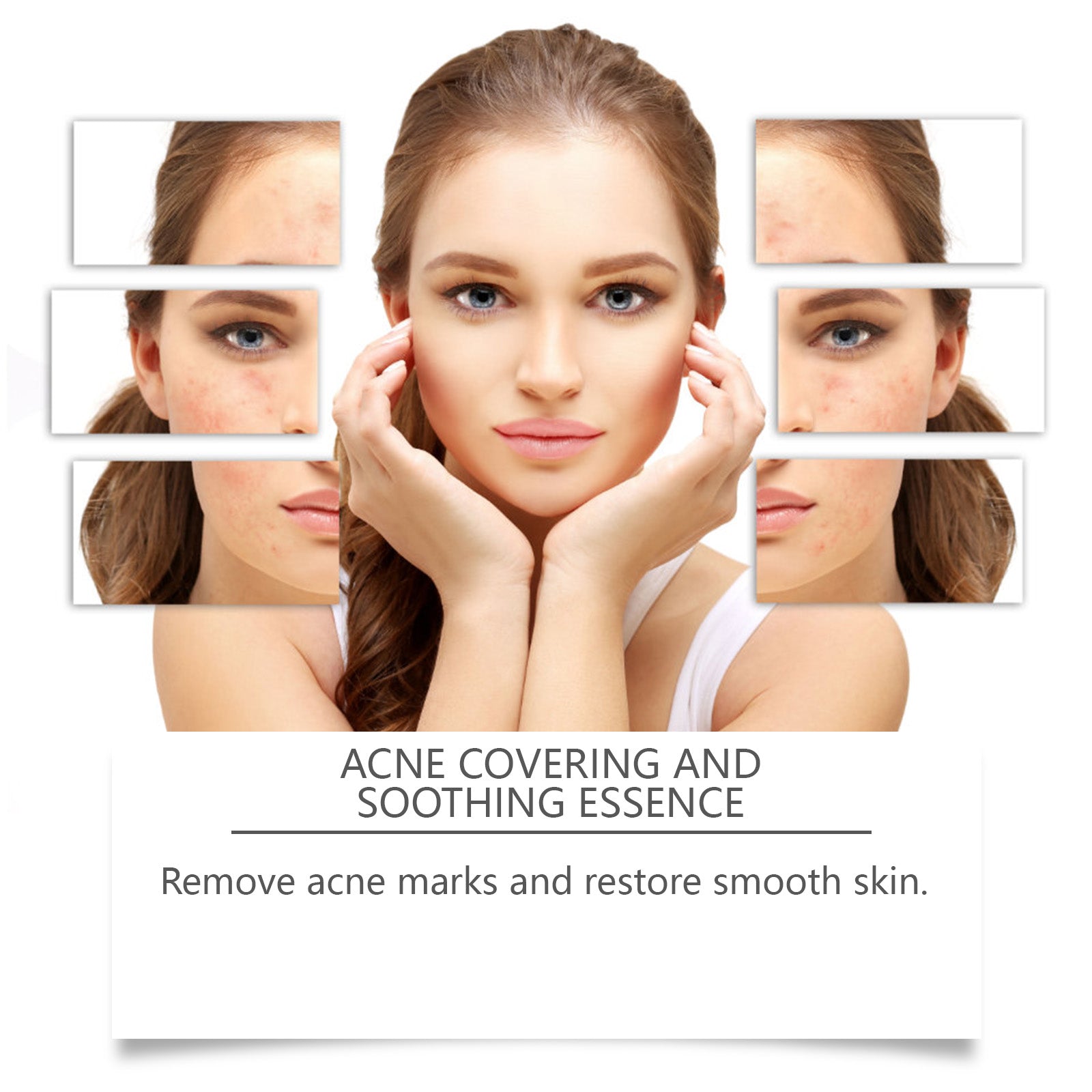 Acne Soothing Hydrating Moisturizing Pimple Care Facial Serum