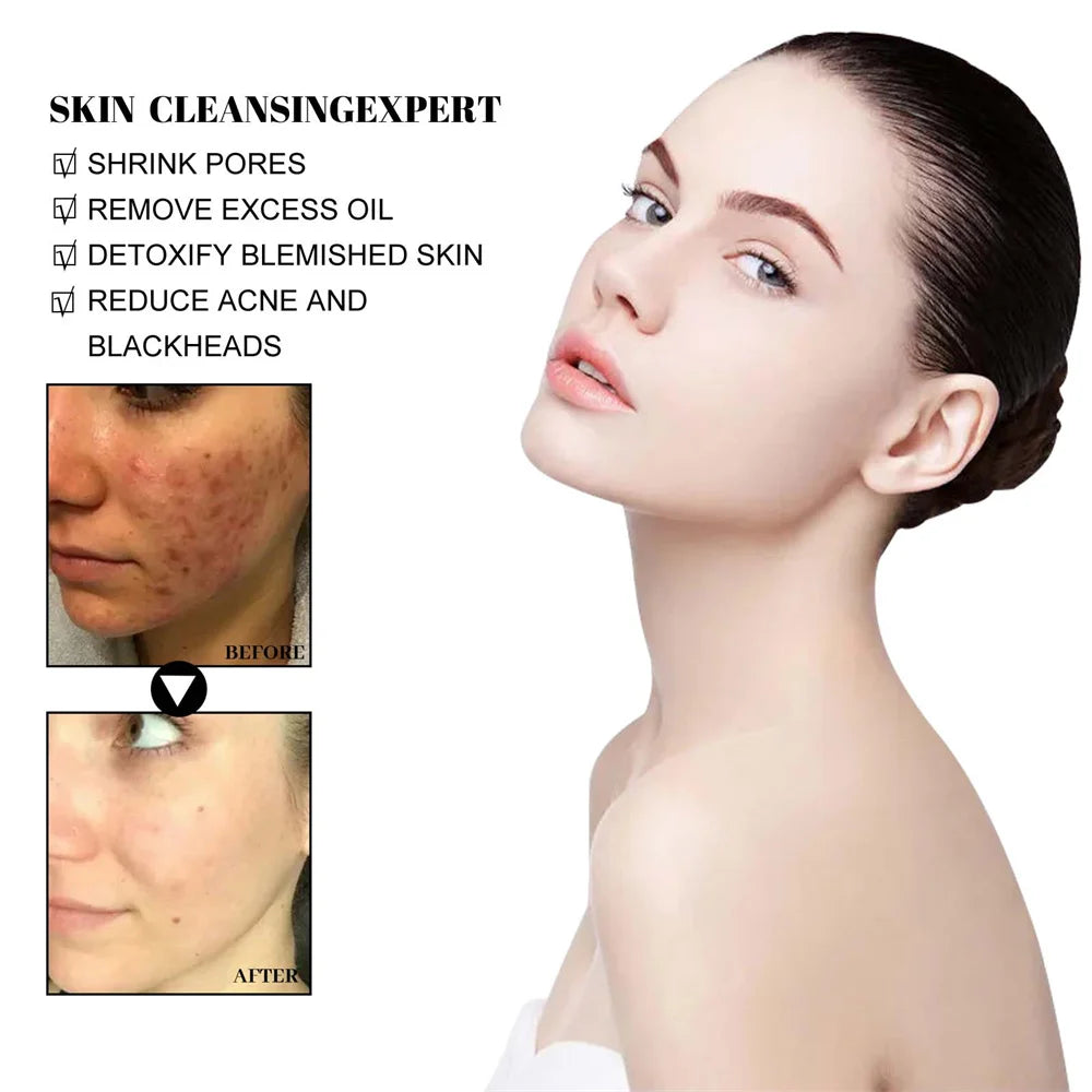 Blackhead Removing Oil Control Refreshing Mud Face Mask